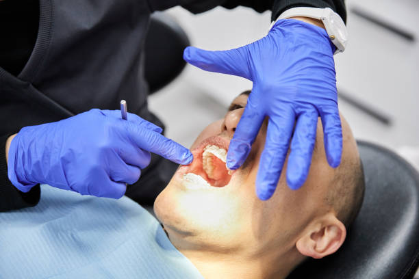Best Emergency Tooth Extraction  in Fort Atkinson, WI
